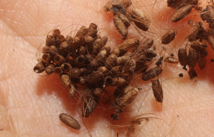 Figura 5. Capullos de parásito <i>Cotesia</i> Whitfield35 ya eclosionado de la familia (Braconidae), parásito en <i>Olceclostera avangareza</i> (Apatelodidae). Voucher 12-SRNP-71419-DHJ802376.jpg.