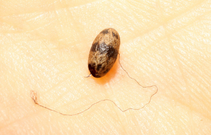 Figura. 11 Párasito Charops GauldADHJ04 (Ichneumonidae) de <i>Phuphena multilinea</i> (Noctuidae), Sector Pitilla, Estación Pitilla (elevación 675 metros). 11 Junio 2009. (09-SRNP-31814-DHJ474051.jpg).